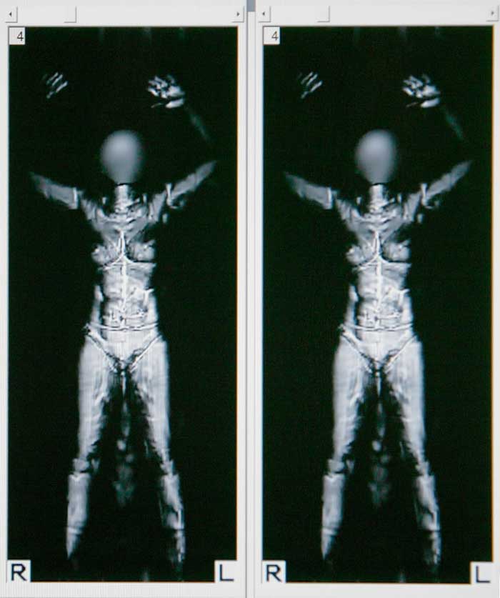 body_2D00_scanner